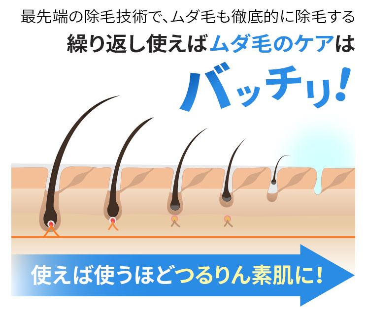 デリーモ口コミ